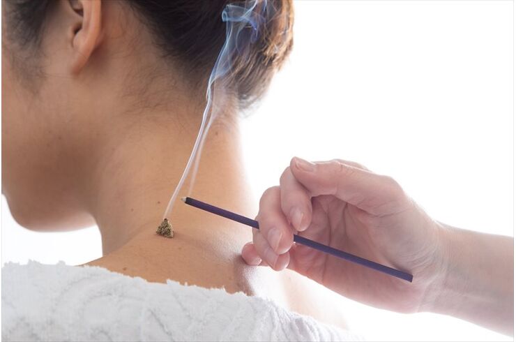 リラックス鍼灸コース